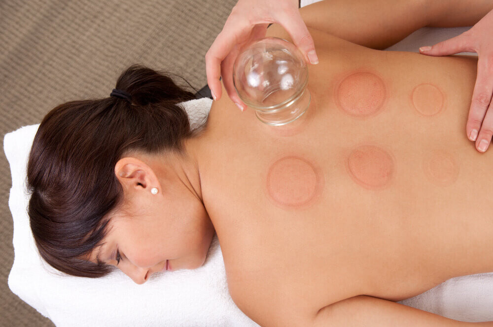 Ventosaterapia (40 min.)